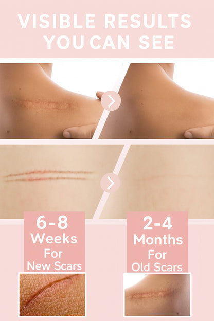 MomGlo™ Collagen Scar Recovery