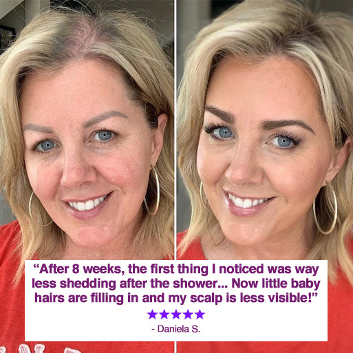 MomGlo™ ReGrow Pro