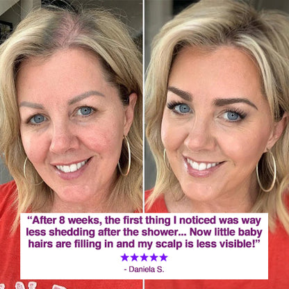 MomGlo™ ReGrow Pro